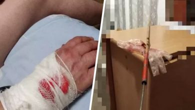 Фото - Подростки ранили самодельным копьем женщину в Пскове