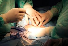 Фото - В Подмосковье хирурги удалили пациентке полулитровую кисту в печени
