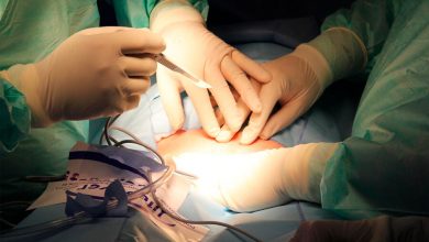 Фото - В Подмосковье хирурги удалили пациентке полулитровую кисту в печени